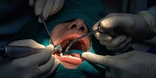Oral Surgery